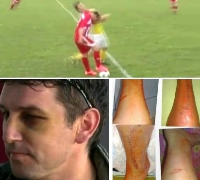 Po tekmi Roma : Tišina - ne dovolite, da športno igrišče postane bojišče!